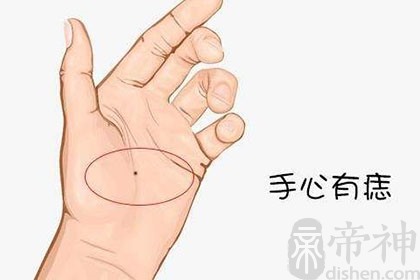 男人手掌有痣代表什么，位置不同痣相不同！