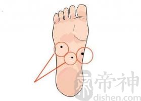 脚底长痣有哪些含义 脚底有痣不同位置长痣痣相分析
