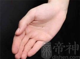 手心里有长红痣黑痣代表什么 手心有痣好不好