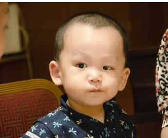 大小眼面相有哪些特点