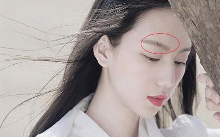 这个地方的痣千万别点掉，乃“旺财痣”，注定是有福之人