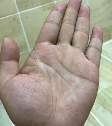 婚姻危机重重的手相，早婚百分百会是离婚命