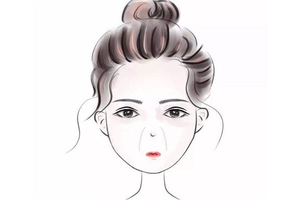 什么是双法令纹？
