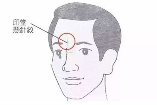 眉心有竖形的纹路好不好