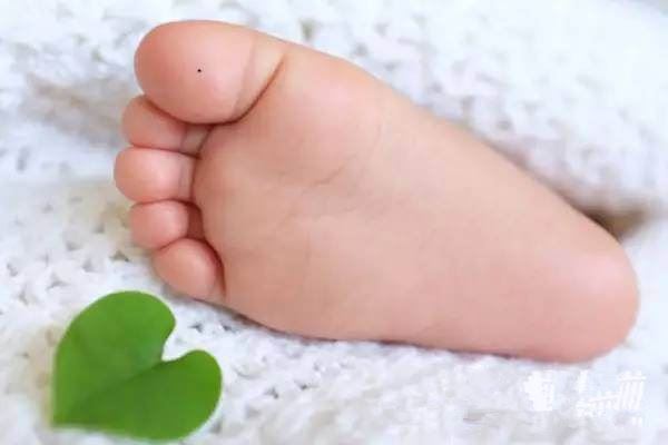 脚心有痣的男人命运如何