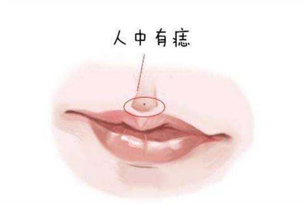 人中有痣好吗