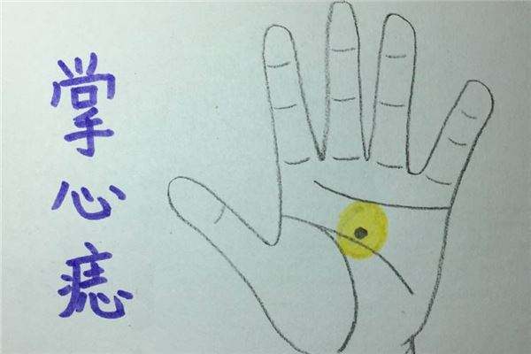 手掌心有痣代表怎么呢？