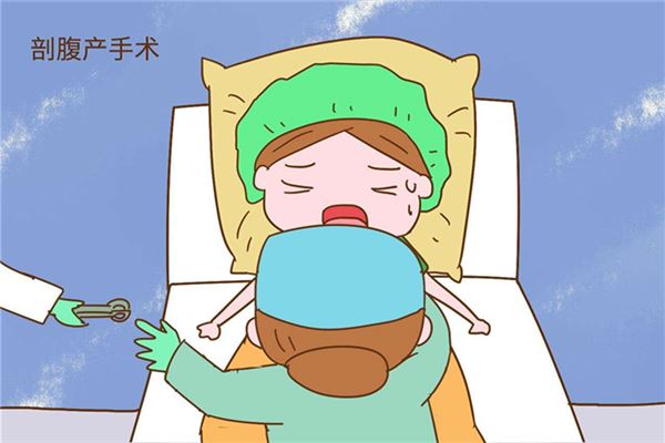剖腹产选日子的讲究