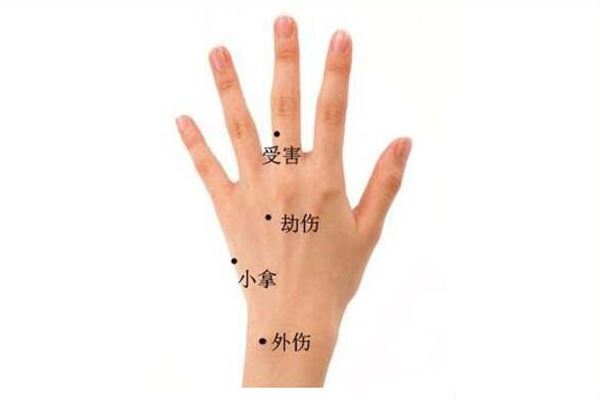 手背上长痣，到底好不好？